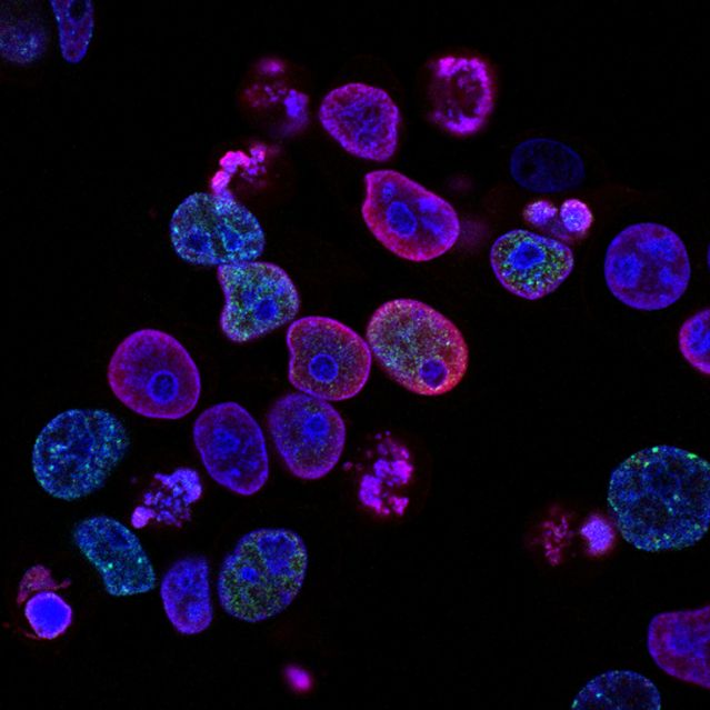 National Cancer Institute/Unsplash National Cancer Institute/Unsplash